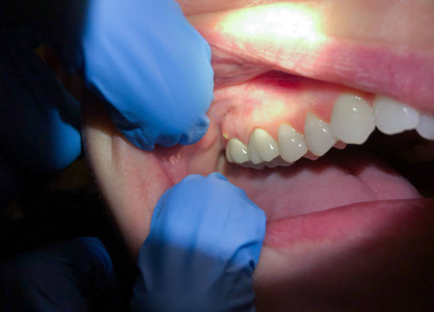 Best Cosmetic Emergency Dentistry in Bucyrus, OH