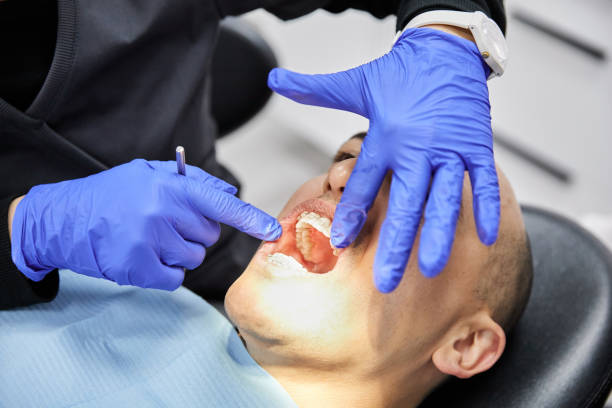 Best Emergency Wisdom Teeth Removal in Bucyrus, OH